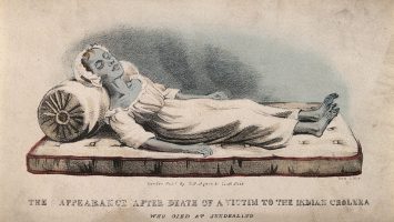 The Appearance After Death of a Victim to the India Cholera